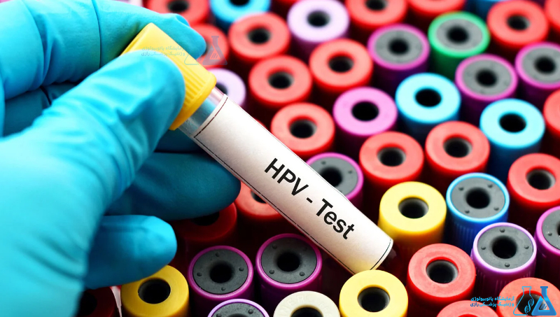 تست HPV در غرب تهران: نگاهی به خدمات آزمایشگاه سما 1 تست HPV در غرب تهران: نگاهی به خدمات آزمایشگاه سما