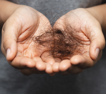 ریزش موی ژنتیکی: یافته‌های جدید و درک بهتر