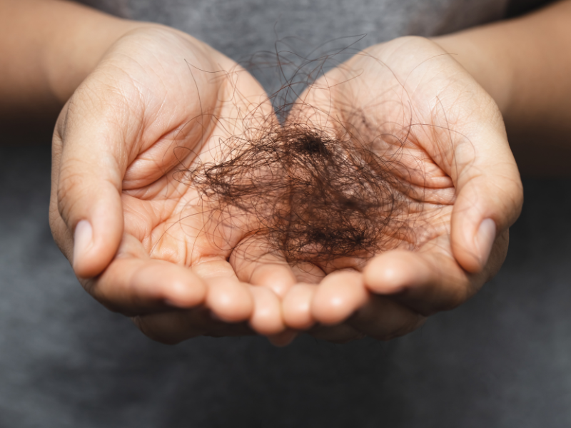 ریزش موی ژنتیکی: یافته‌های جدید و درک بهتر