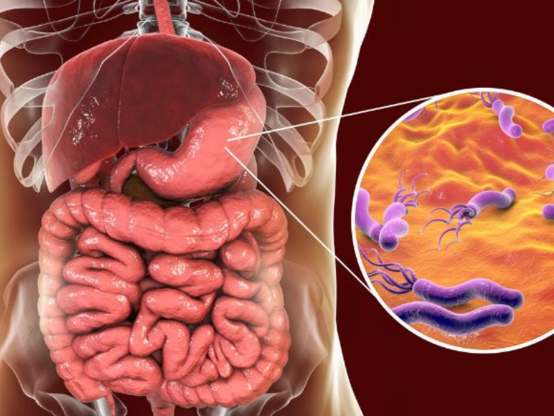 هلیکوباکتر پیلوری: شناخت، تشخیص و درمان 1 هلیکوباکتر پیلوری: شناخت، تشخیص و درمان