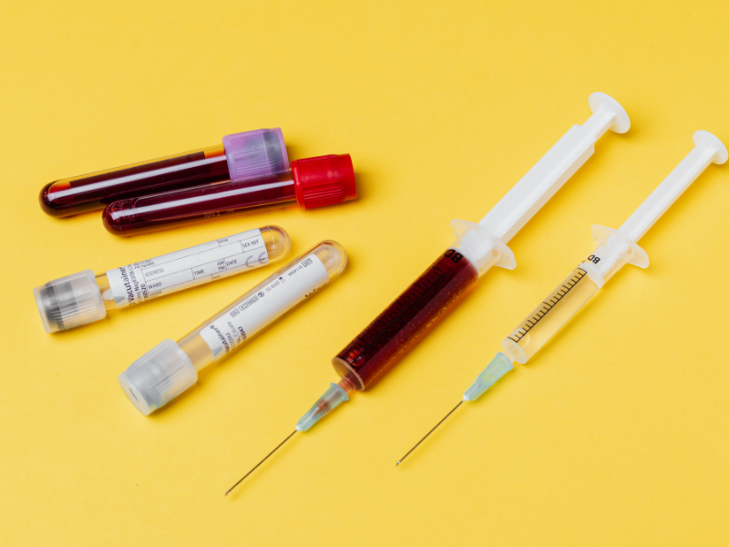 پیشگیری از سرطان دهانه رحم: نقش حیاتی تست HPV آزمایشگاه سما 1 پیشگیری از سرطان دهانه رحم: نقش حیاتی تست HPV آزمایشگاه سما