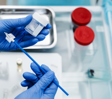 چه زمانی انجام تست HPV ضروری است؟ بررسی اهمیت تست HPV در آزمایشگاه سما