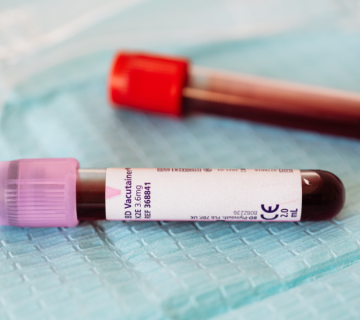 آیا بیماری HPV از آب استخر منتقل میشود؟ 9 آیا بیماری HPV از آب استخر منتقل میشود؟