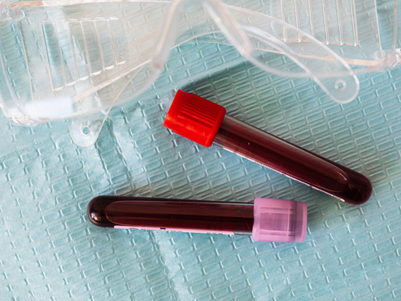 استفاده از تستهای ژنتیکی برای تشخیص زودهنگام سرطان خون 1 استفاده از تستهای ژنتیکی برای تشخیص زودهنگام سرطان خون