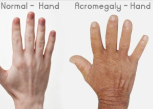 آزمایش IGF-1 چیست؟