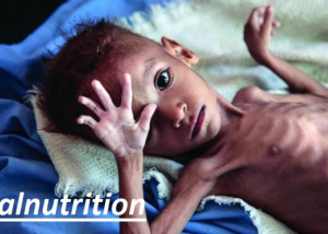 آزمایش IGF-1 چیست؟