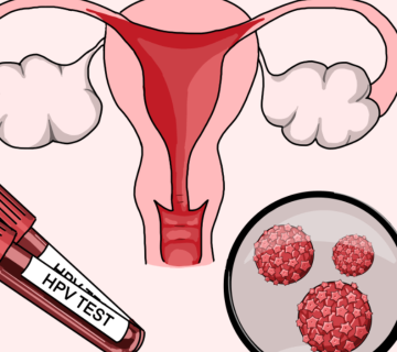 دقت آزمایش HPV چقدر است؟