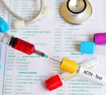 آزمایش ACTH چیست؟