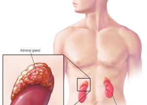 آزمایش ACTH چیست؟ 2 آزمایش ACTH چیست؟