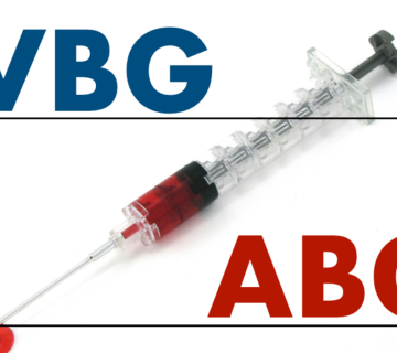 آزمایش VBG چیست؟