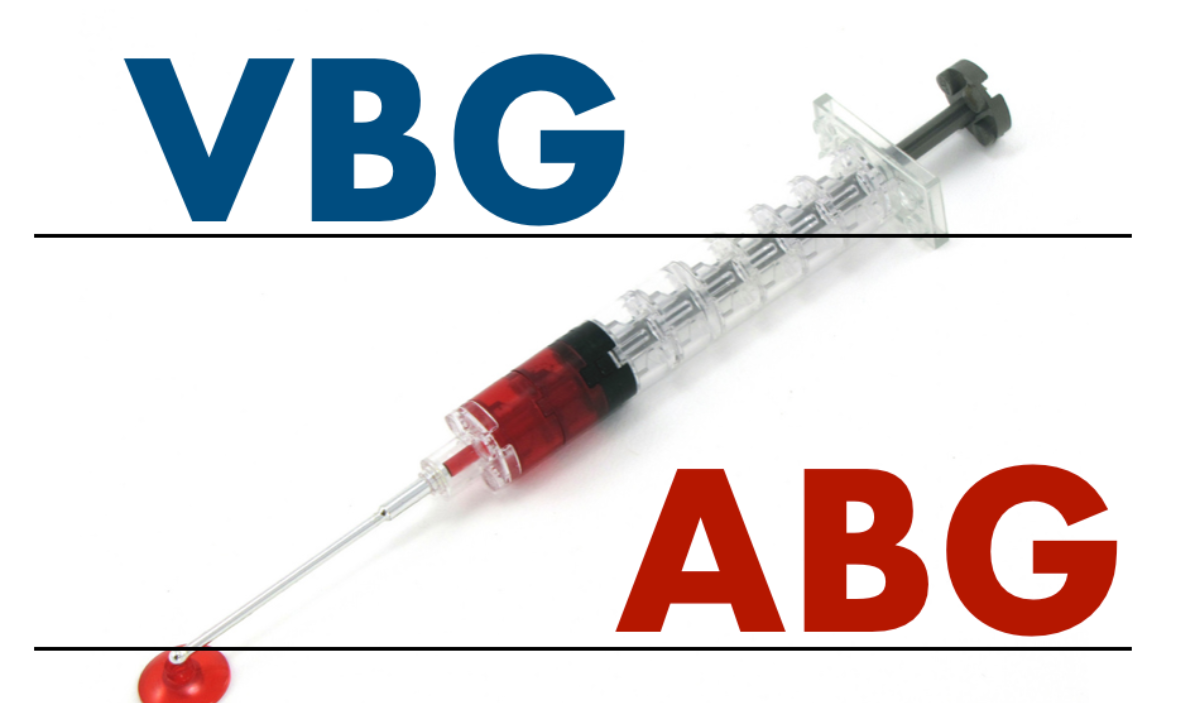 آزمایش VBG چیست؟