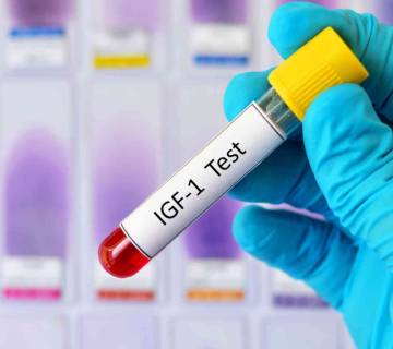 آزمایش IGF-1 چیست؟