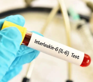 آزمایش اینترلوکین-۶ یا IL-6 سایتوکاینی چیست؟