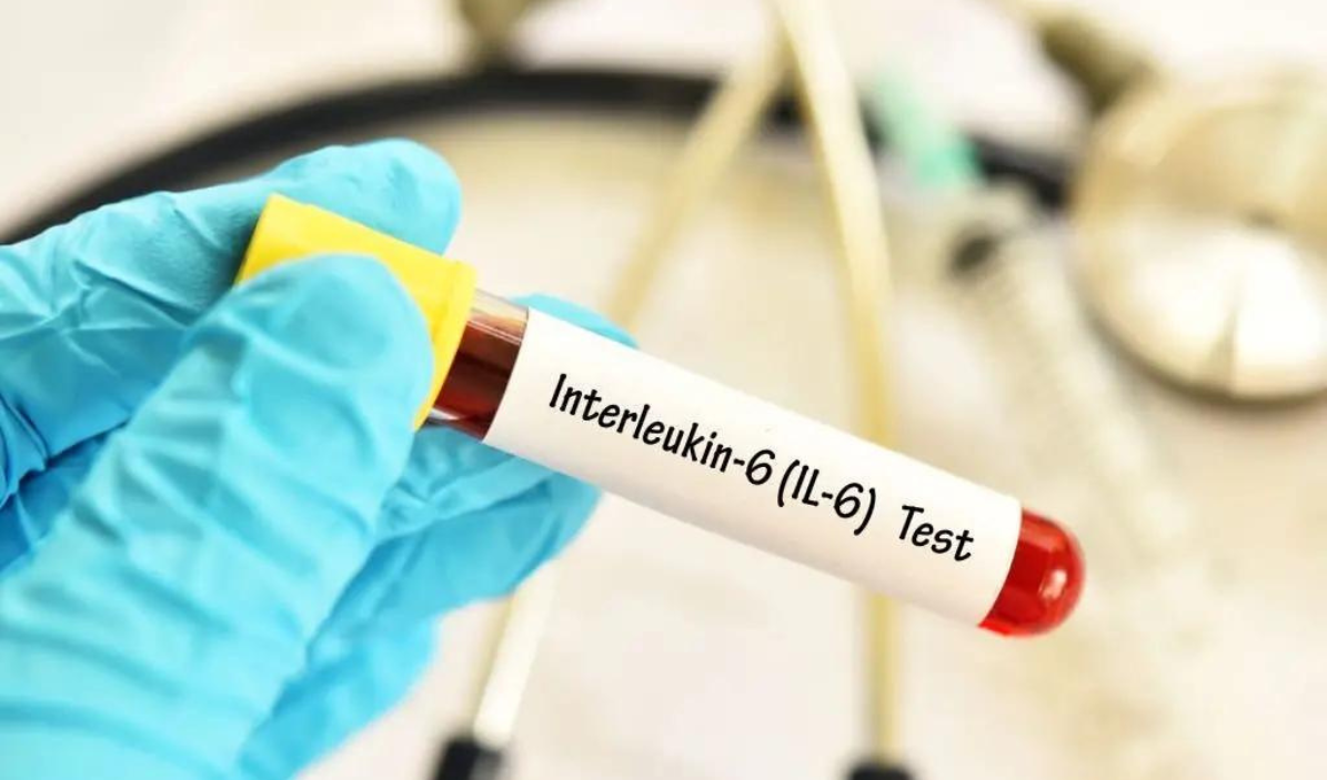 آزمایش اینترلوکین-۶ یا IL-6 سایتوکاینی چیست؟ 1 آزمایش اینترلوکین-۶ یا IL-6 سایتوکاینی چیست؟