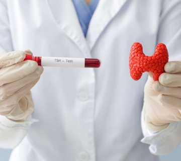 آزمایش TSH Receptor Ab چیست؟