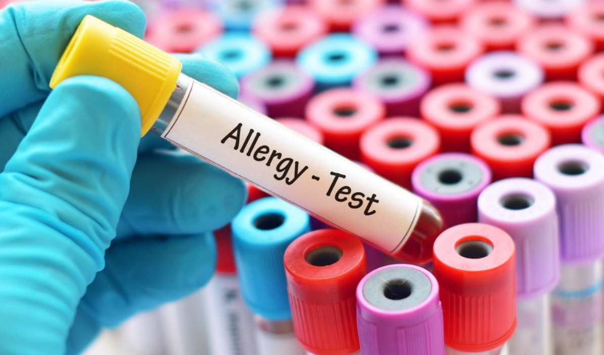 آزمایش RAST آلرژی چیست؟ 1 آزمایش RAST آلرژی چیست؟