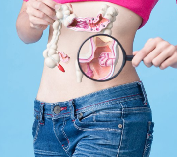 تست ژنتیک و سرطان روده بزرگ