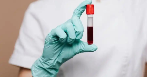 چرا آزمایش آلرژی حیاتی است؟ 4 آزمایش خون