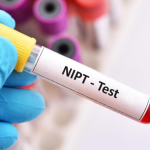 آزمایش NIPT (سل فری): انقلابی در تشخیص پیش از تولد