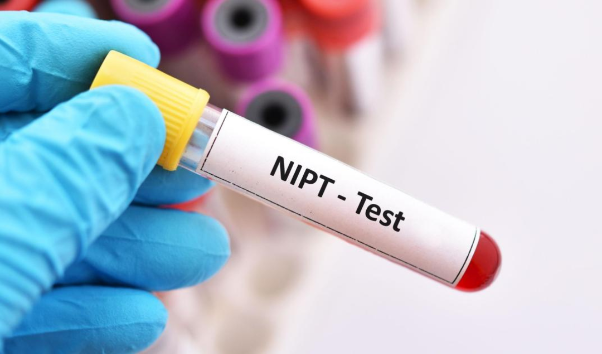 آزمایش NIPT (سل فری): انقلابی در تشخیص پیش از تولد 1 آزمایش NIPT (سل فری): انقلابی در تشخیص پیش از تولد