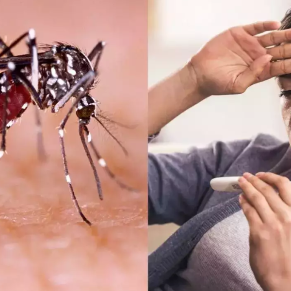 آزمایش تب دنگی در آزمایشگاه سما آزمایش تب دنگی در آزمایشگاه سما